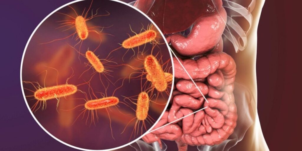 Health Implications of E. coli Infection